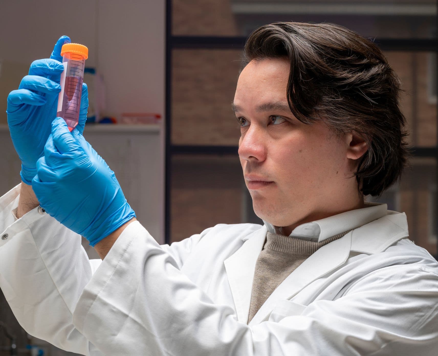 Associate Professor Simon Jiang inspects a medical sample while wearing a lab coat. His work aims to create personalised care.