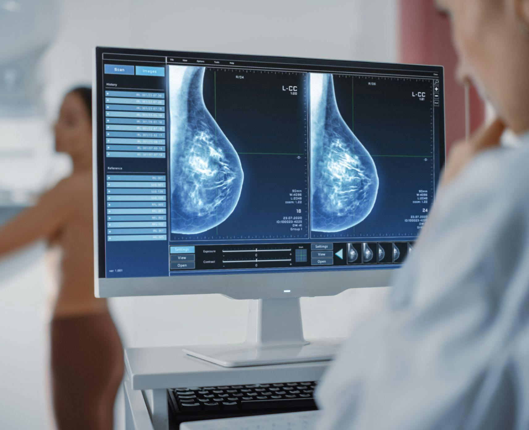 A woman having a mammography screening done.