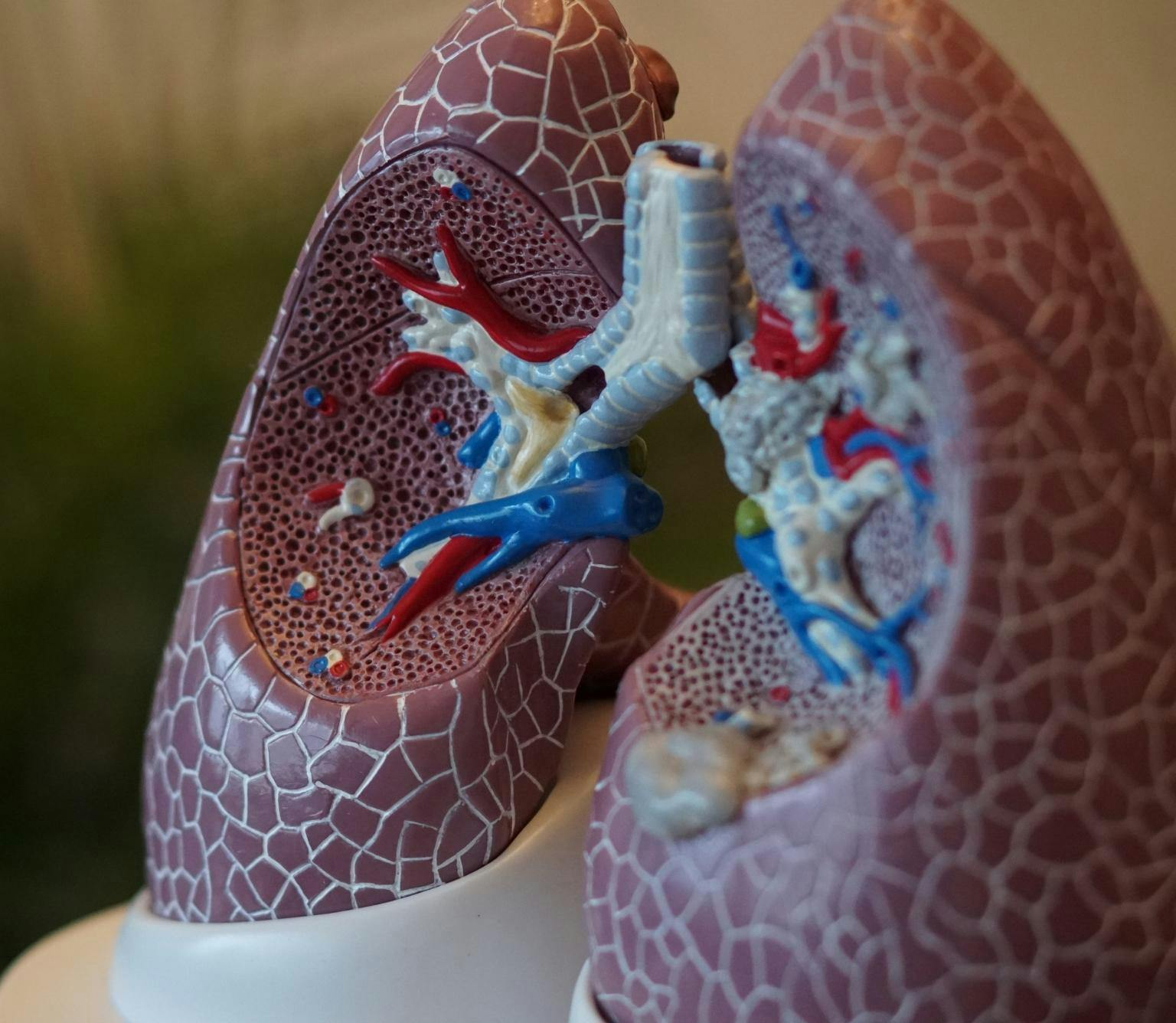 Medical model with a cross-section cutout of human lungs. The lungs are purple and have red and blue veins.