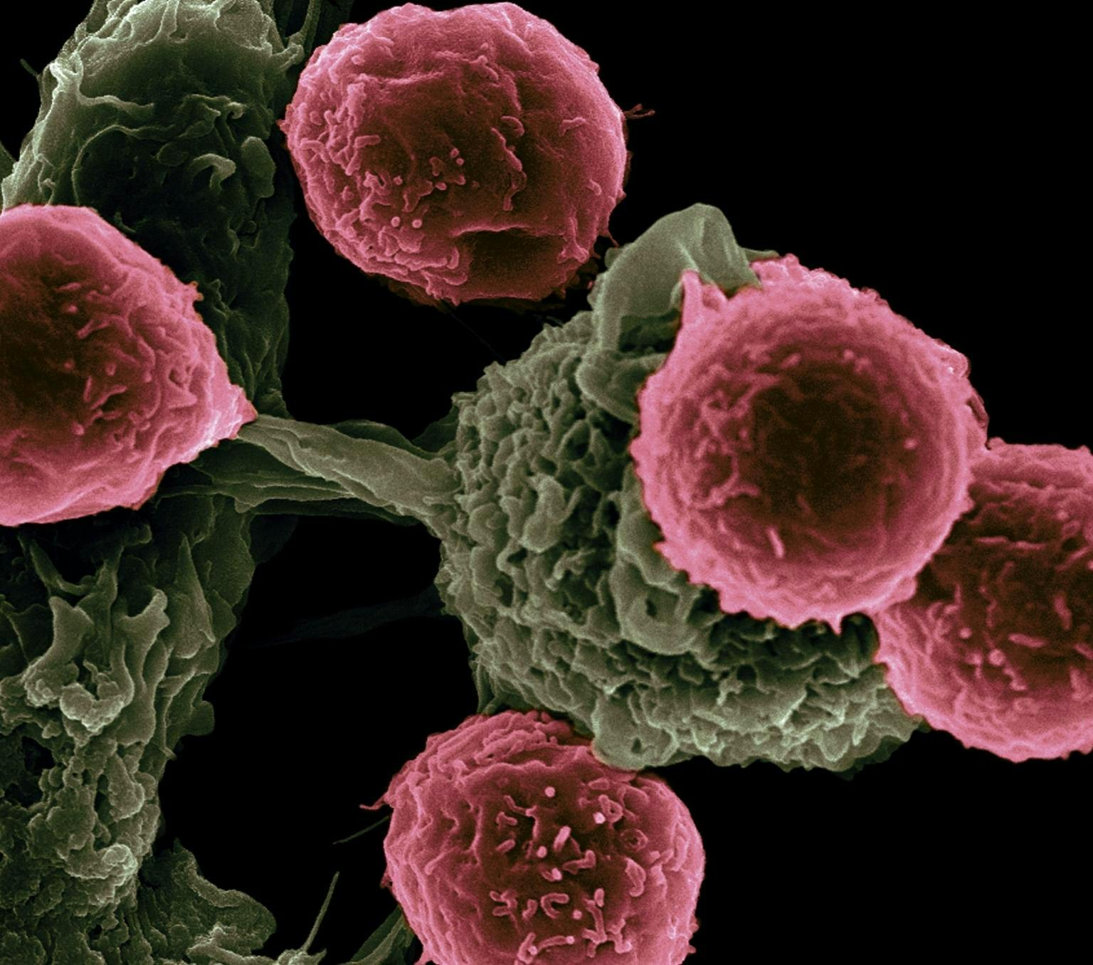 scanning electron microscope image shows dendritic cells, pseudo-colored in green, interacting with T cells, pseudo-colored in pink.